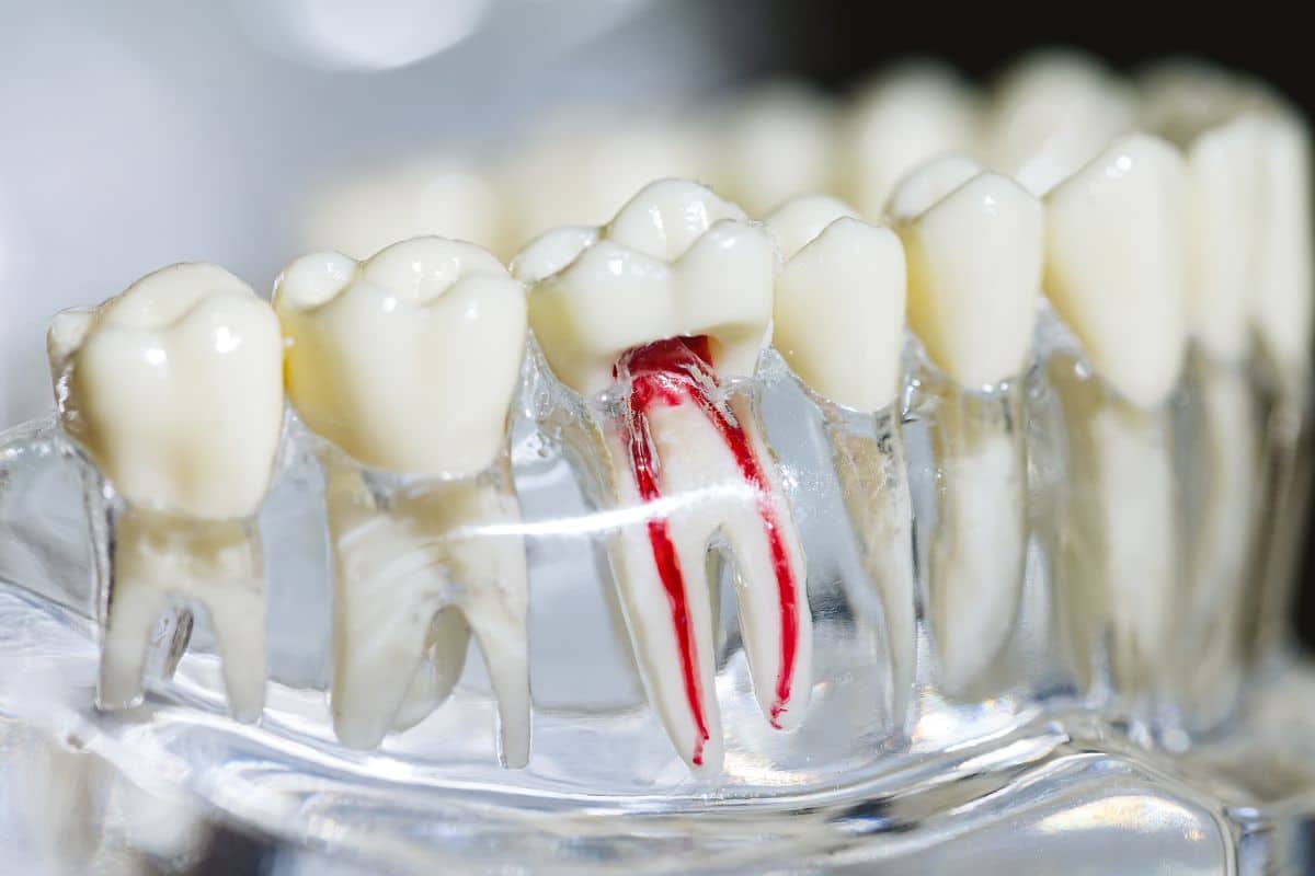Root Canal Treatments In Vijayapura
