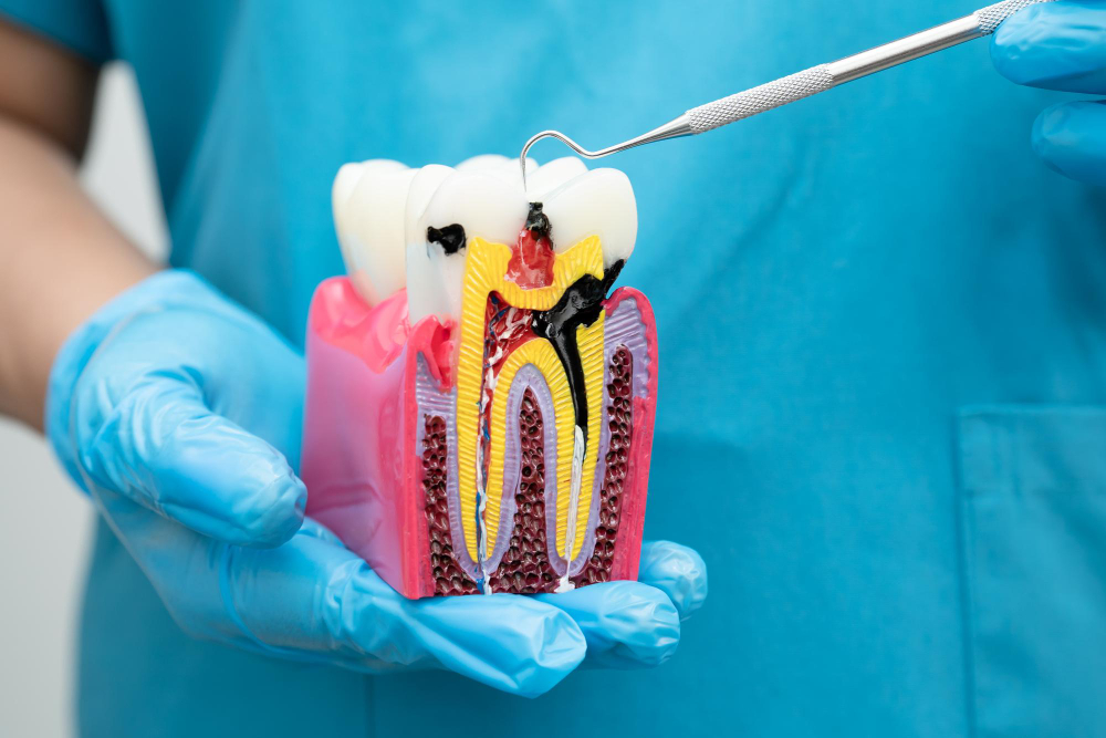 Root Canal Treatment In Vijayapura