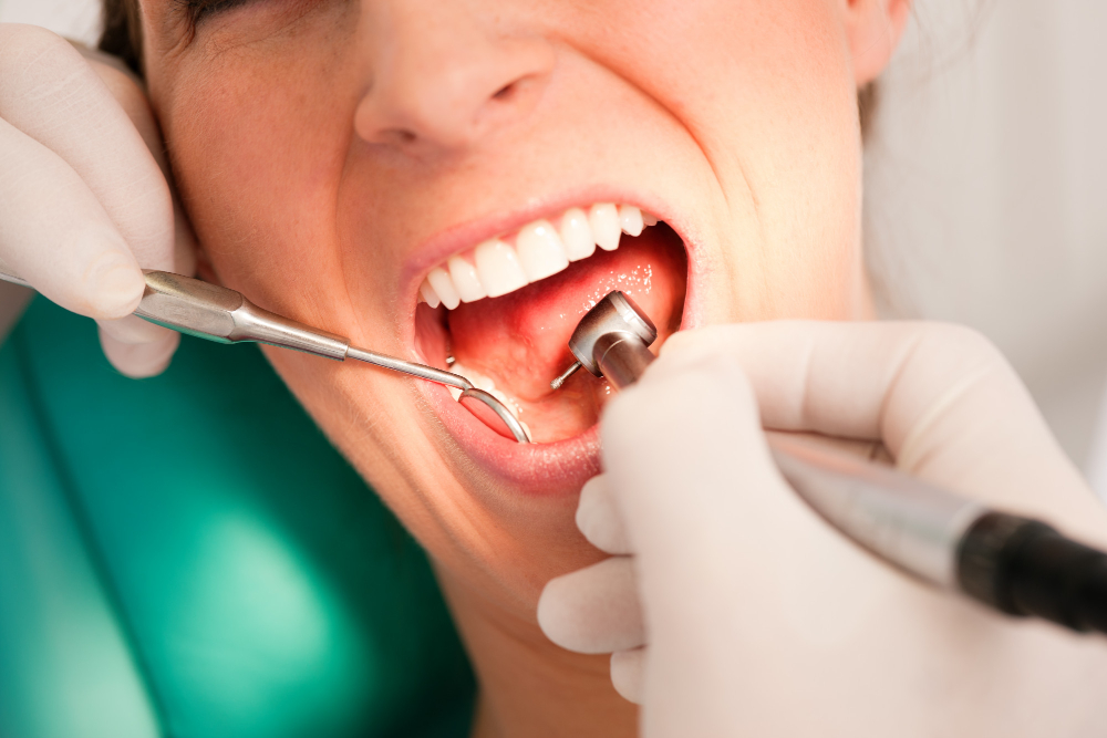 Clear Aligners vs. Traditional Braces: Which is Right for You?